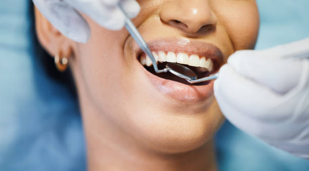 Best Emergency Treatment for Dental Infections or Abscesses in Fayetteville, WV